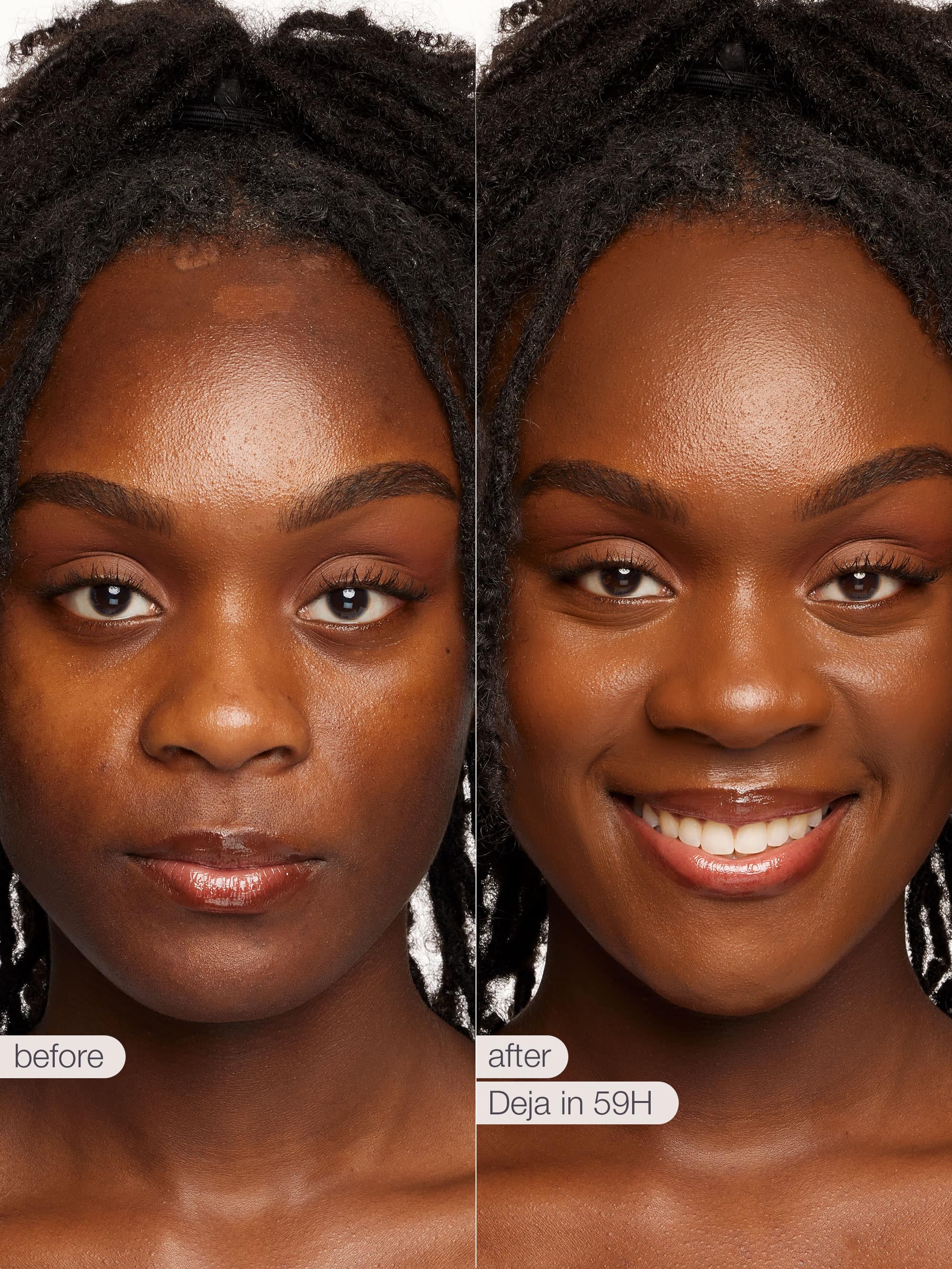 Before and after comparison of a woman's face with text indicating a product name.