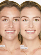 Before and after comparison of a woman's face with visible skin treatment results.