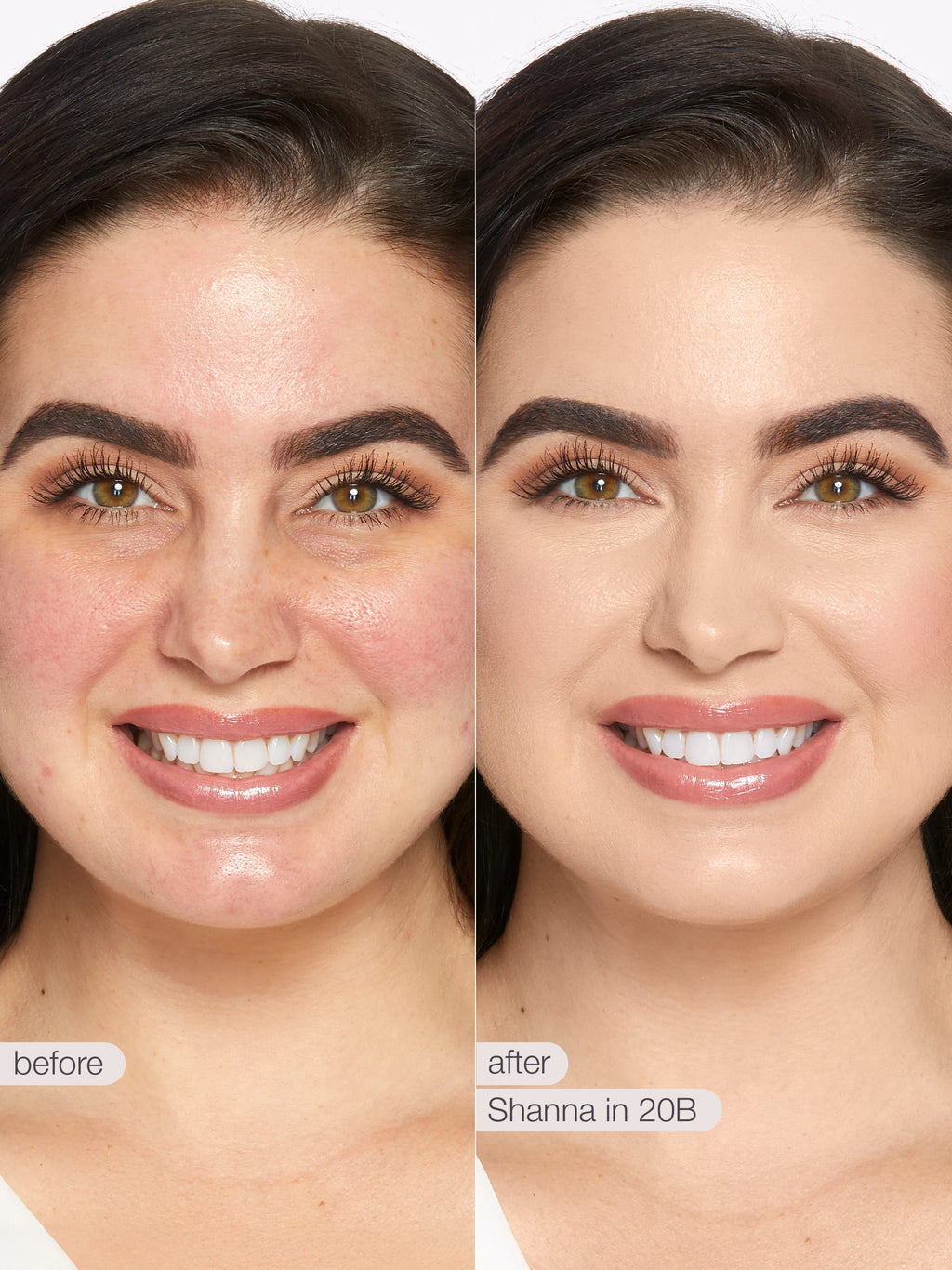 Before and after comparison of a woman's smile with cosmetic effects applied, labeled 'Shanna in 20B'. using Tarte shape tape cloud coverage 