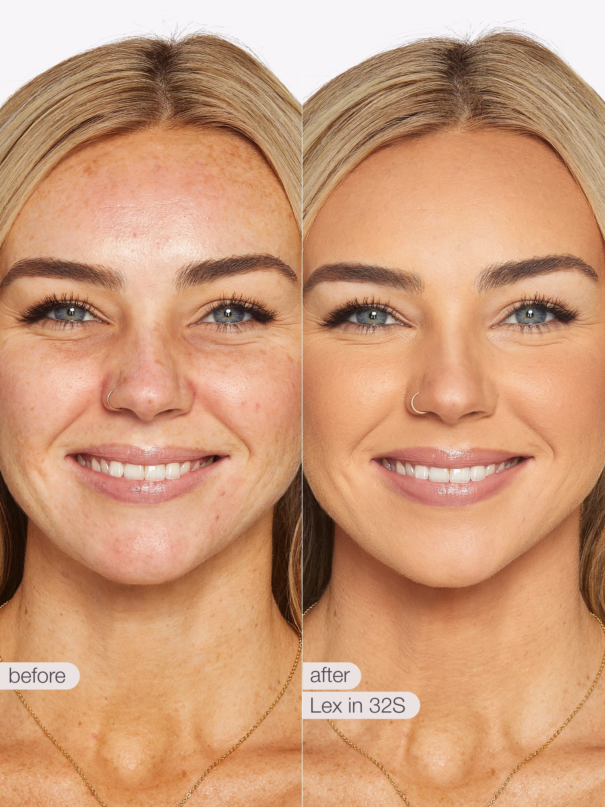 Before and after comparison of a woman's face with visible skin improvement. using Tarte shape tape cloud coverage 