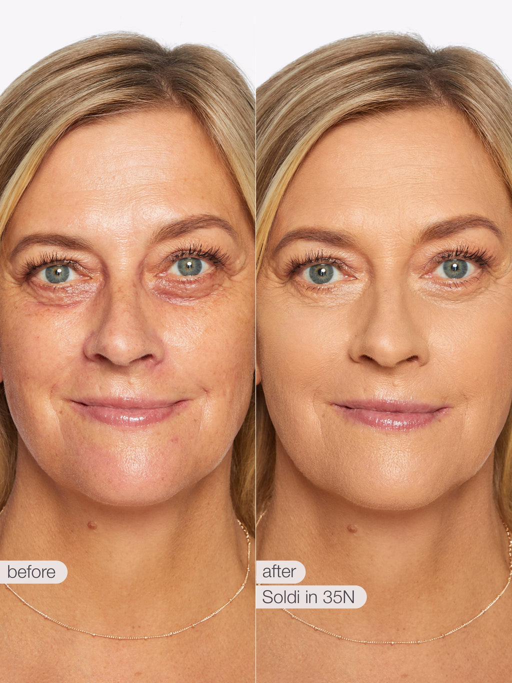 Before and after comparison of a woman's face with visible skin improvement. using Tarte shape tape cloud coverage 