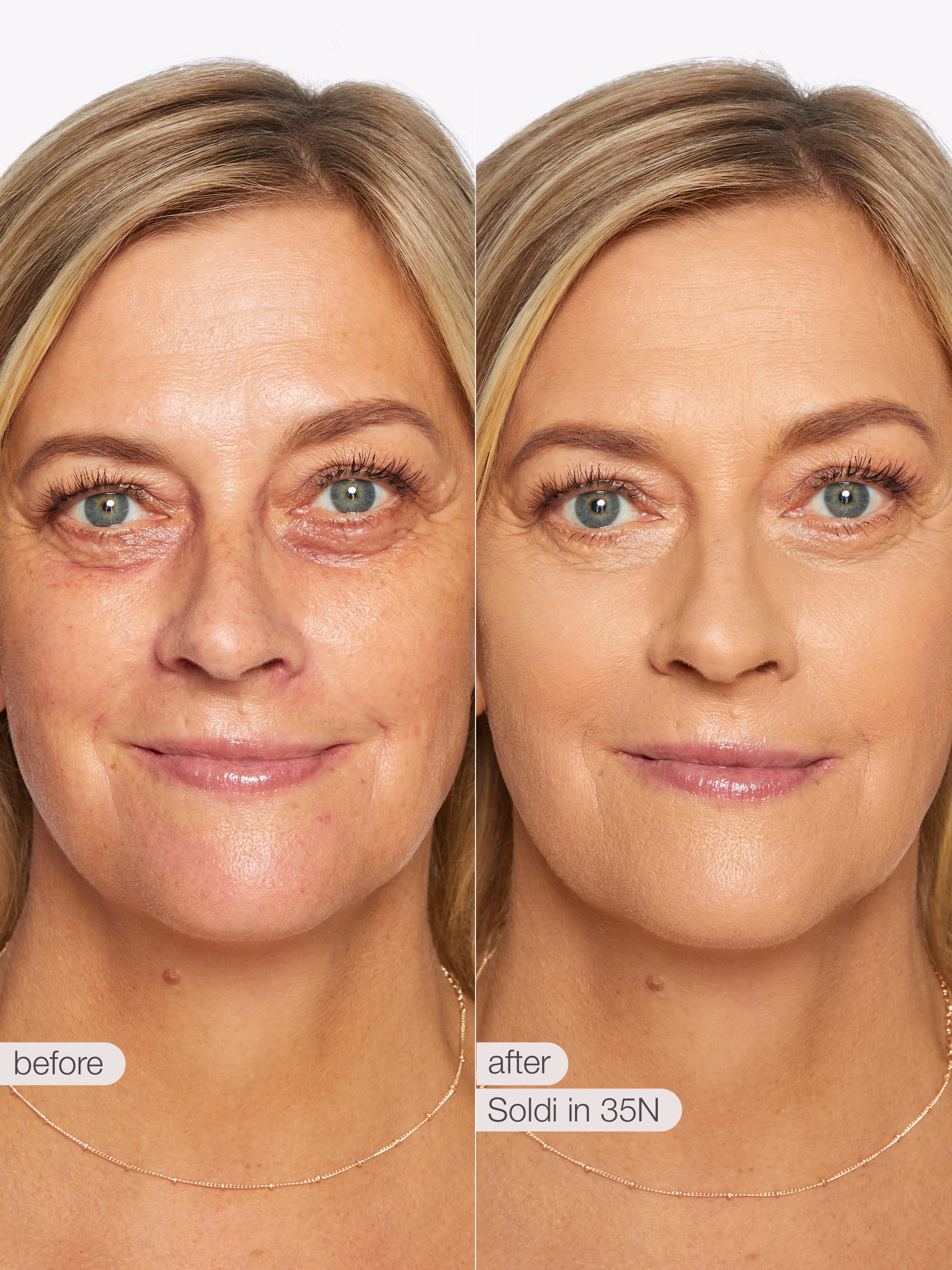 Before and after comparison of a woman's face with visible skin improvement. using Tarte shape tape cloud coverage 