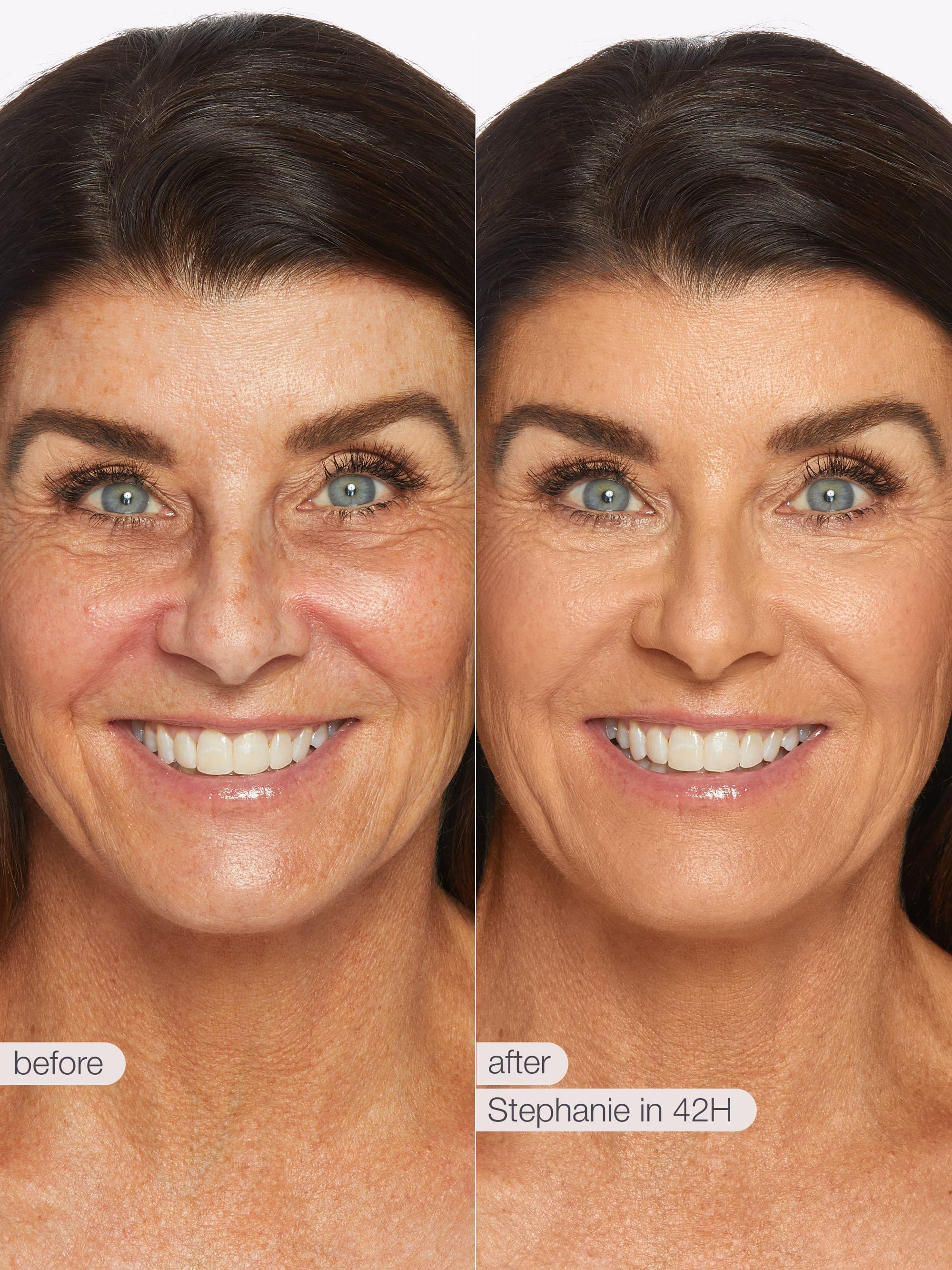 Before and after comparison of a woman's face with visible skin improvement. using Tarte shape tape cloud coverage 