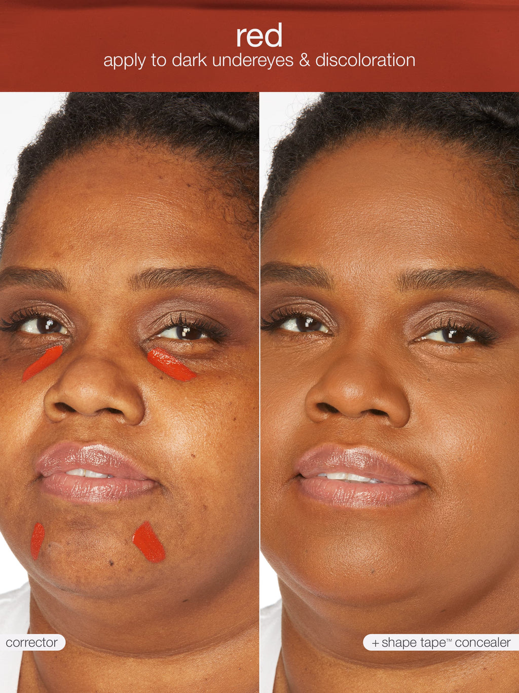 shape tape™ corrector
