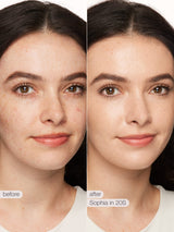 Before and after comparison of a woman's face with visible skin improvement.