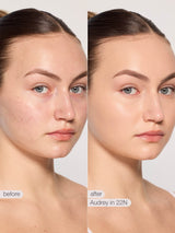 Before and after comparison of a woman's face with skin treatment labeled 'Nellie in 22N'.