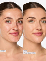 Before and after comparison of a woman's face with text indicating 'Amanda in 27H'.