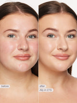 Before and after comparison of a woman's face with text indicating a skincare treatment.