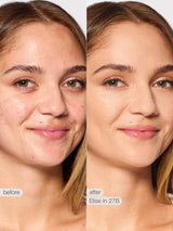 Before and after comparison of a woman's face with text labels 'before' and 'after' on a plain background.