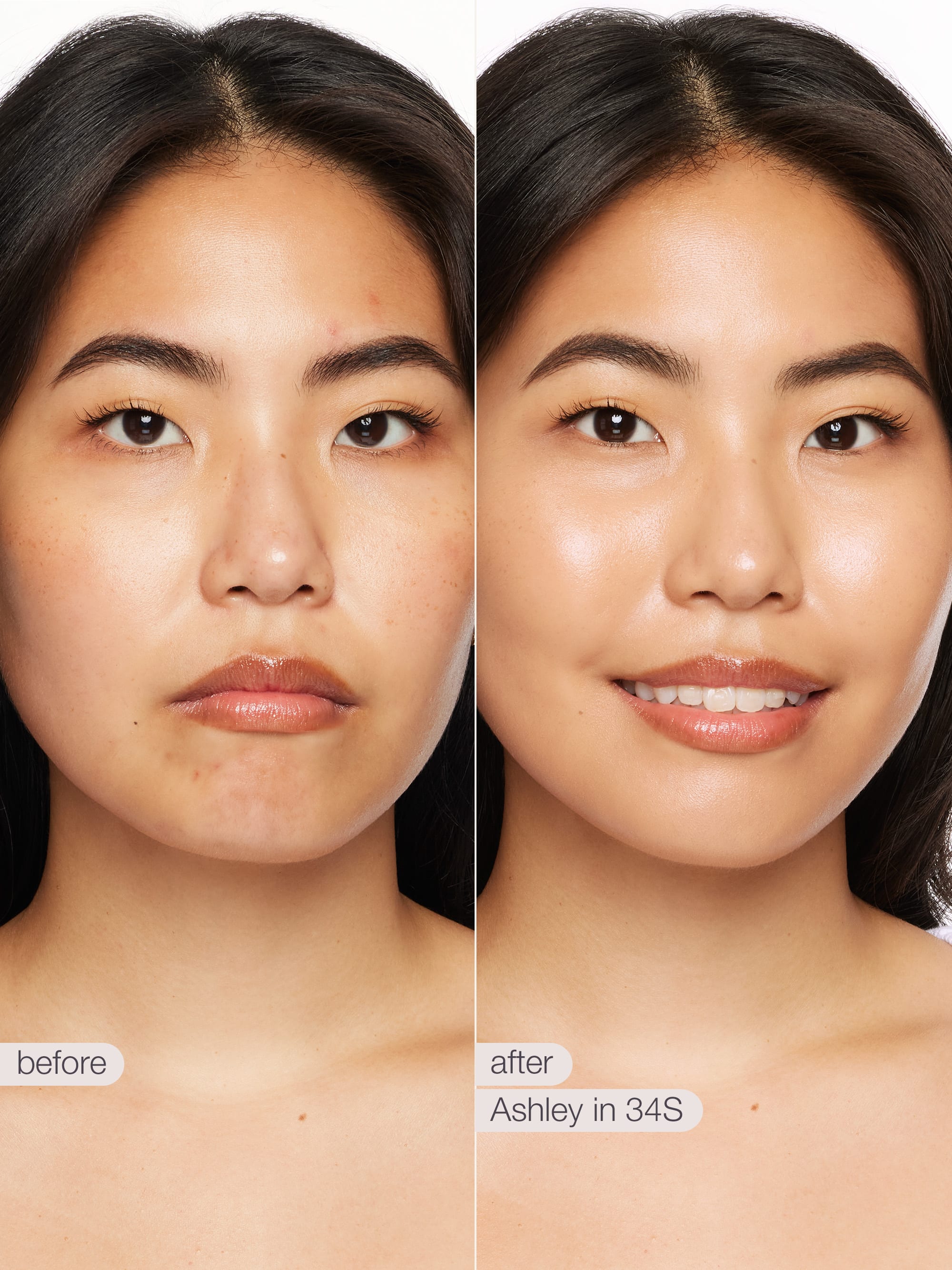 Before and after comparison of a woman's face with text labels 'before' and 'after' on a white background.