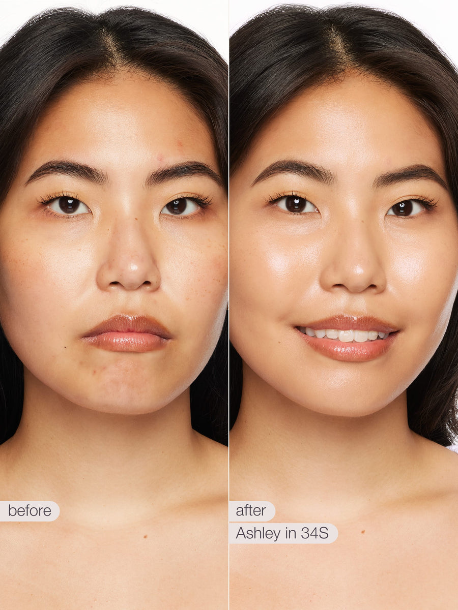 Before and after comparison of a woman's face with text labels 'before' and 'after' on a white background.