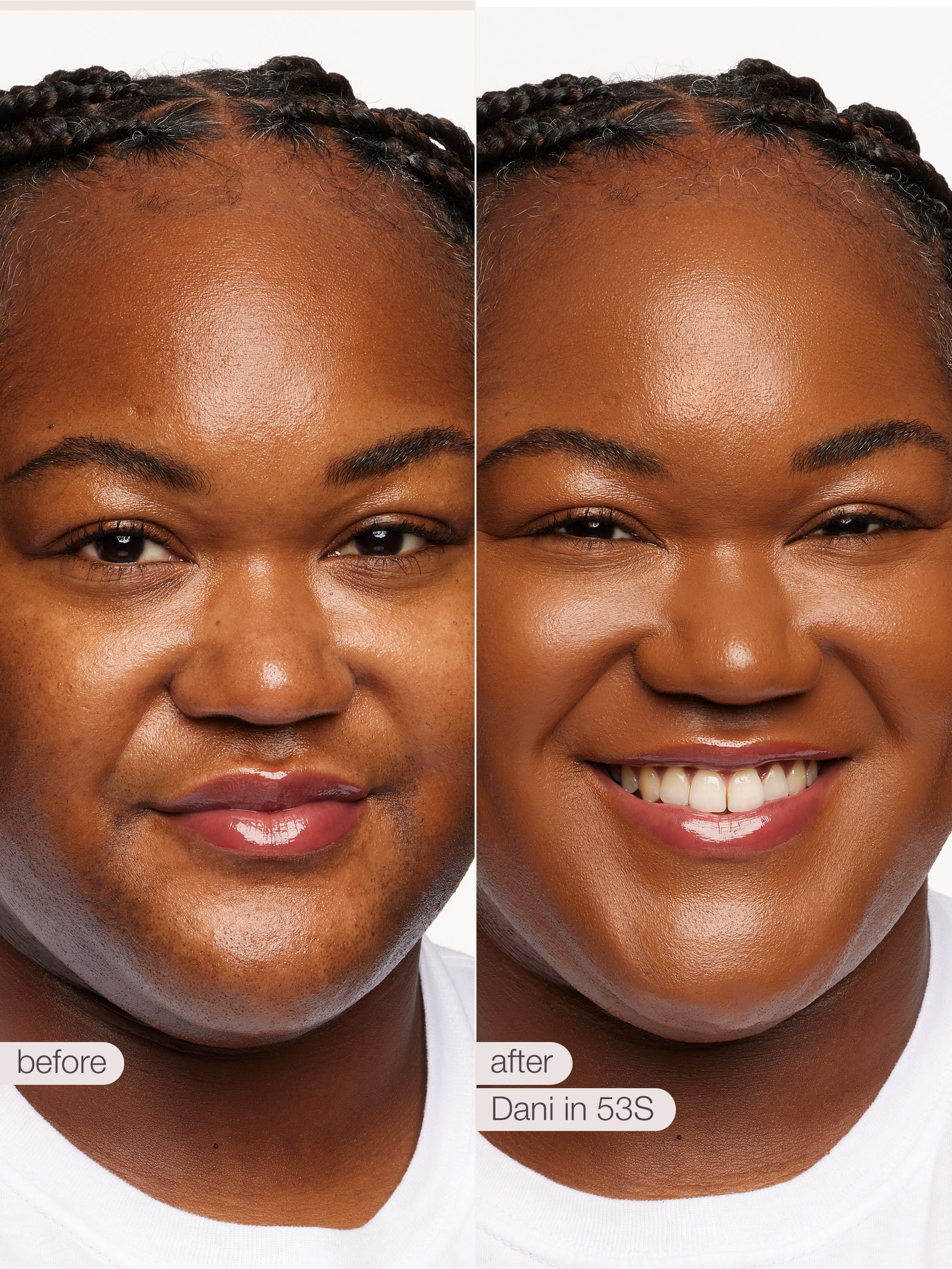 Before and after comparison of a woman's face with text indicating 'before' and 'after' and 'Dani in 53S'.