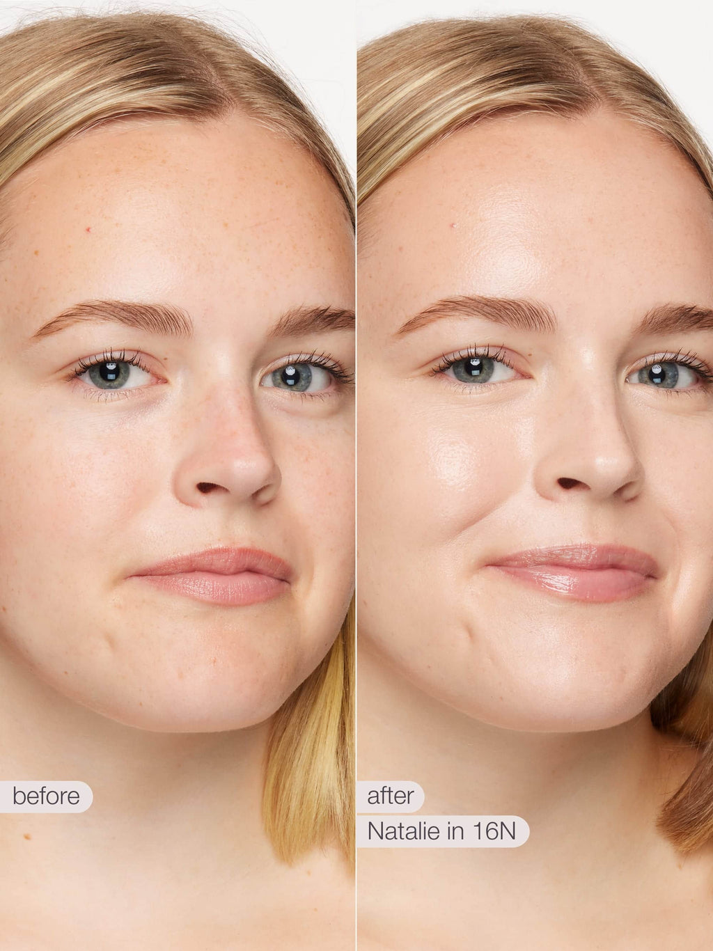 Before and after comparison of a woman's face with text labels 'before' and 'after'.
