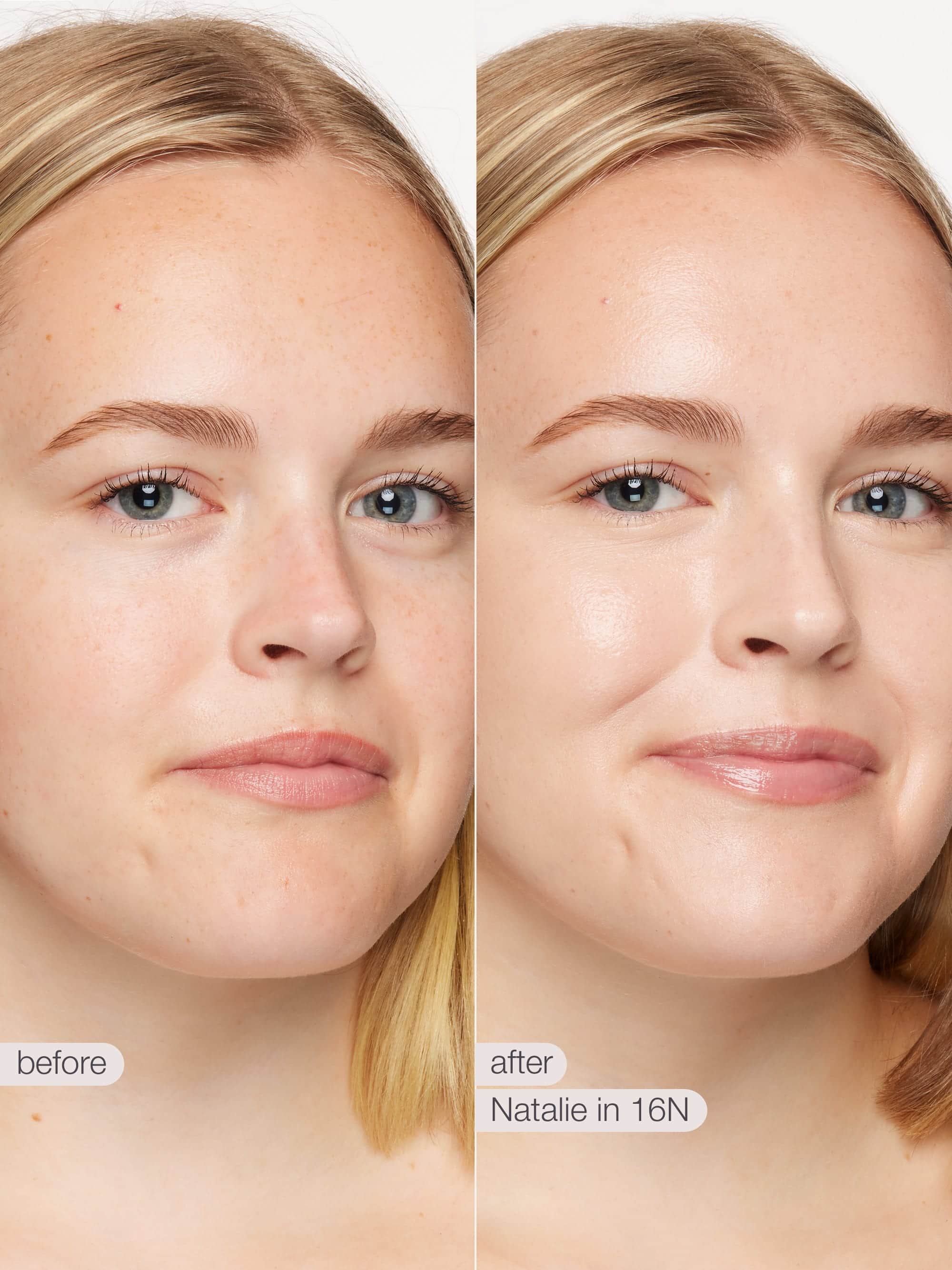 Before and after comparison of a woman's face with text labels 'before' and 'after'.