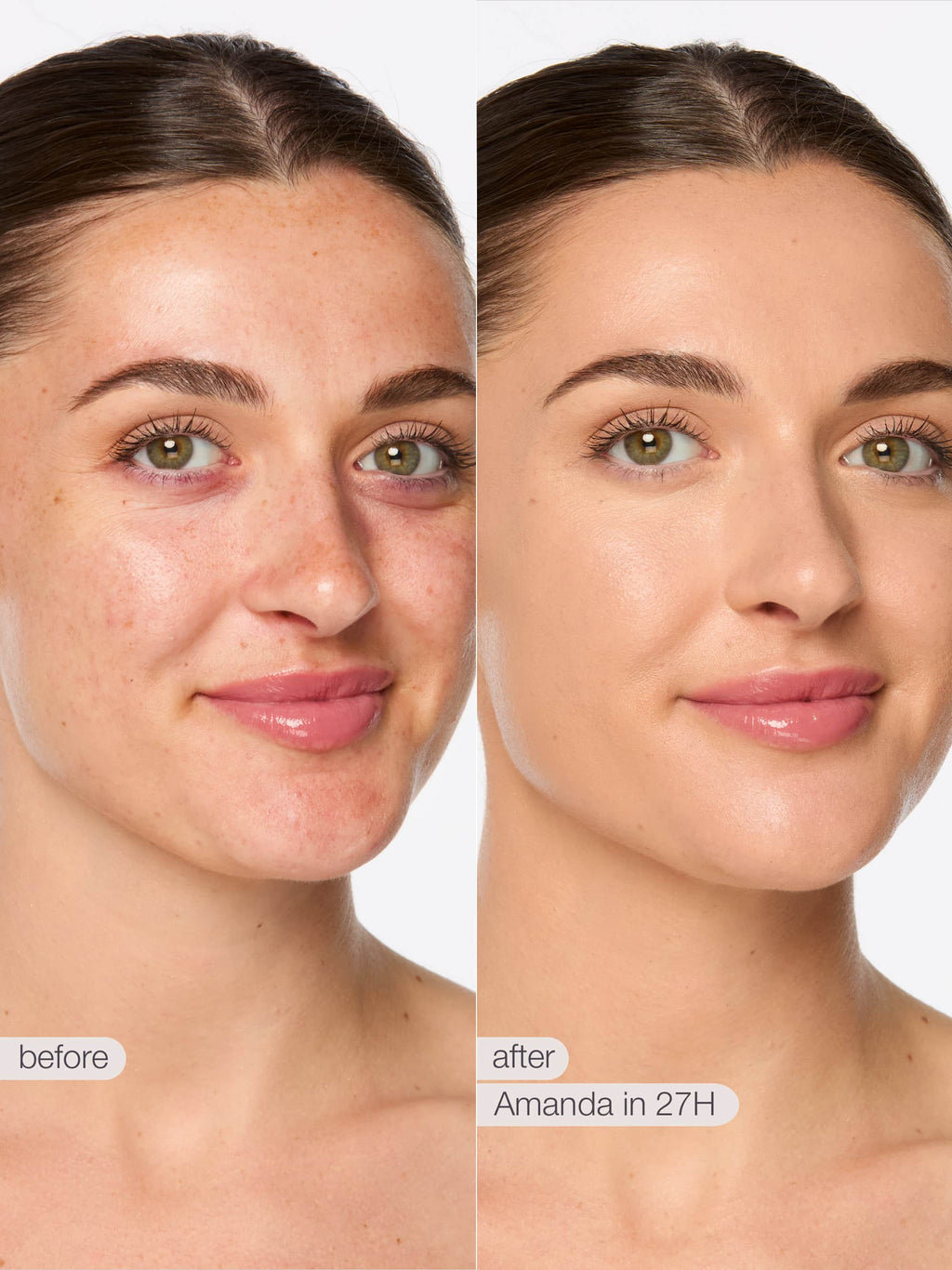 Before and after comparison of a woman's face with text indicating time elapsed.