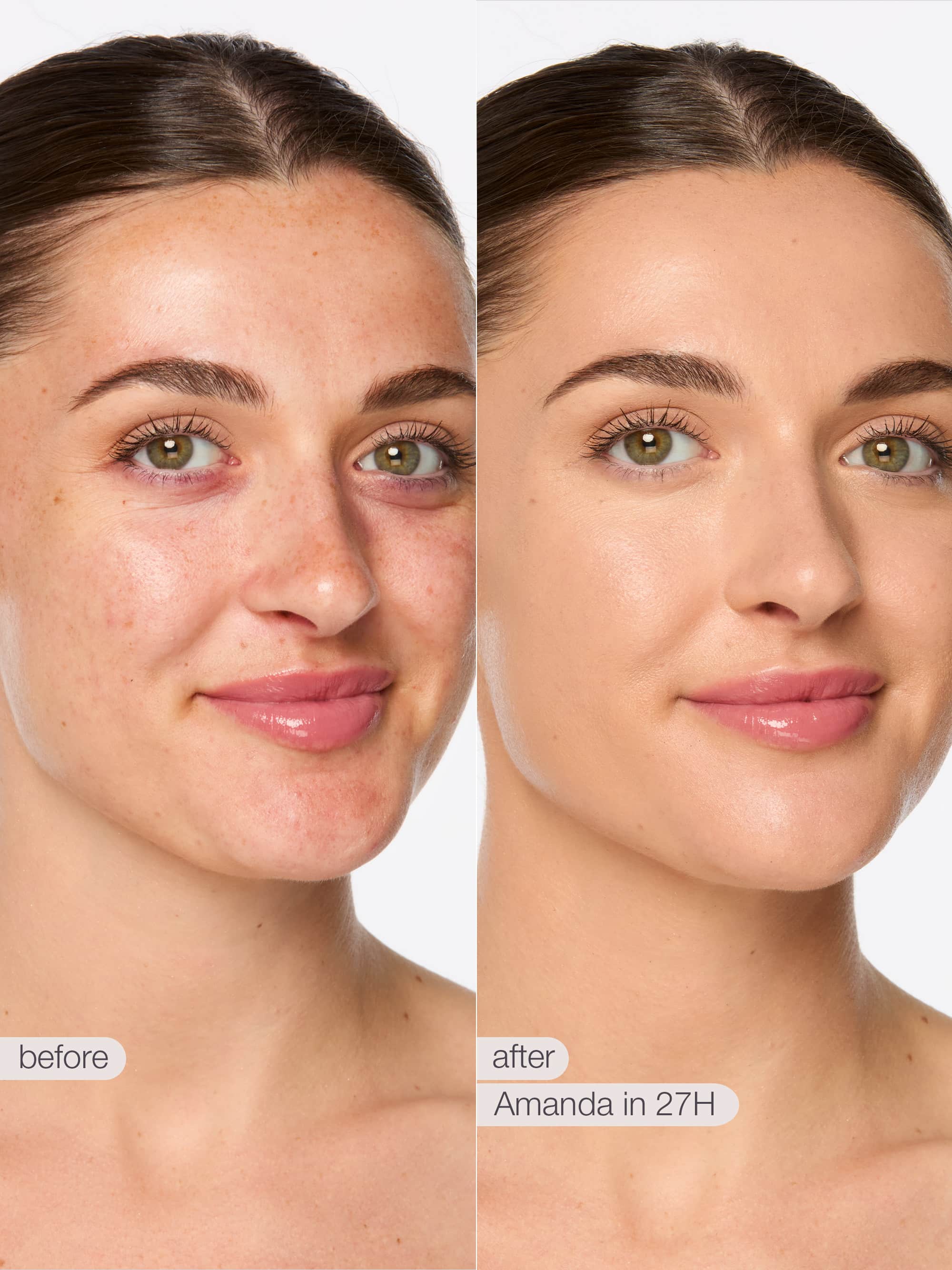 Before and after comparison of a woman's face with text indicating time elapsed.