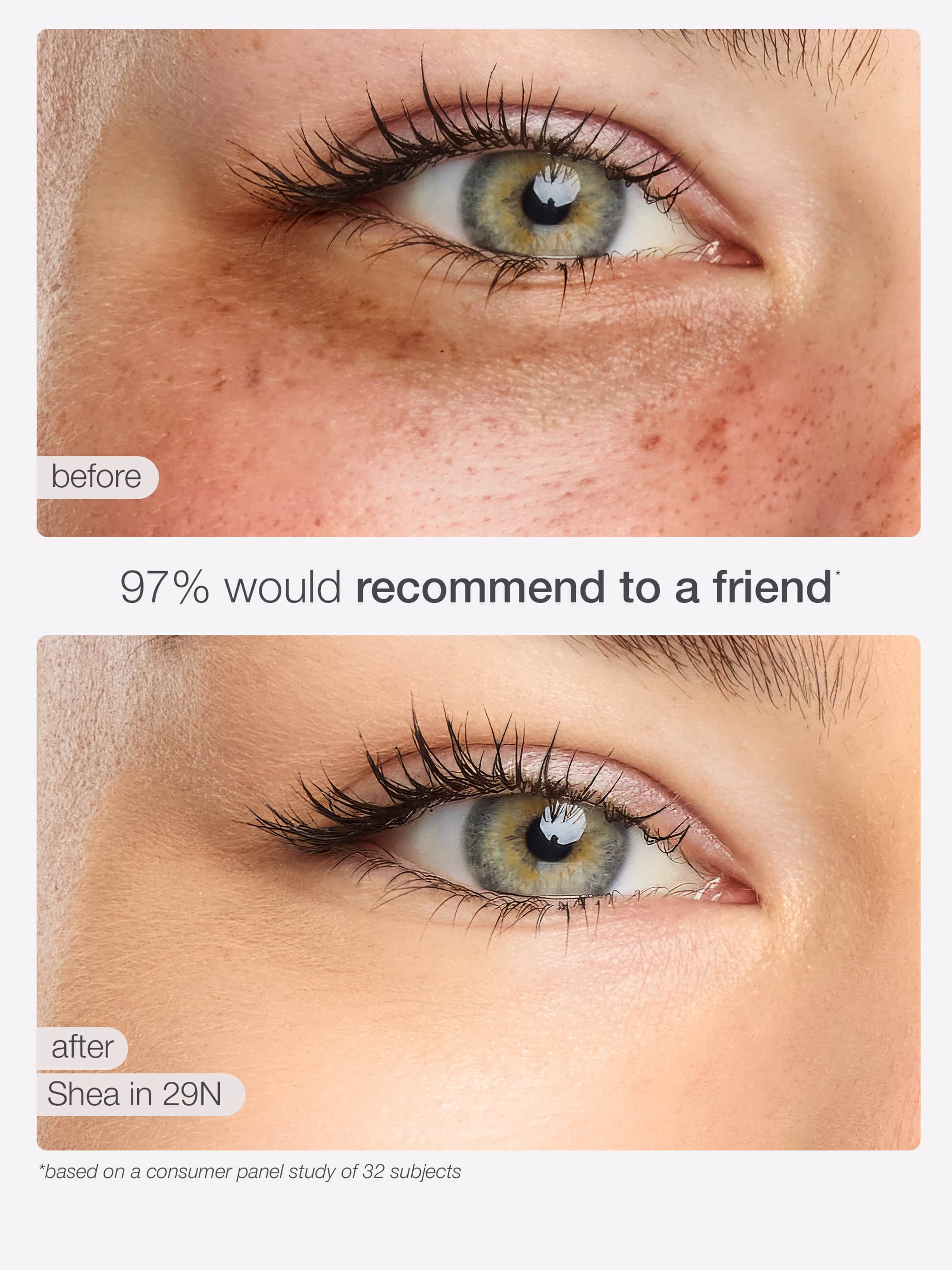 Before and after comparison of eye treatment with a visible improvement.