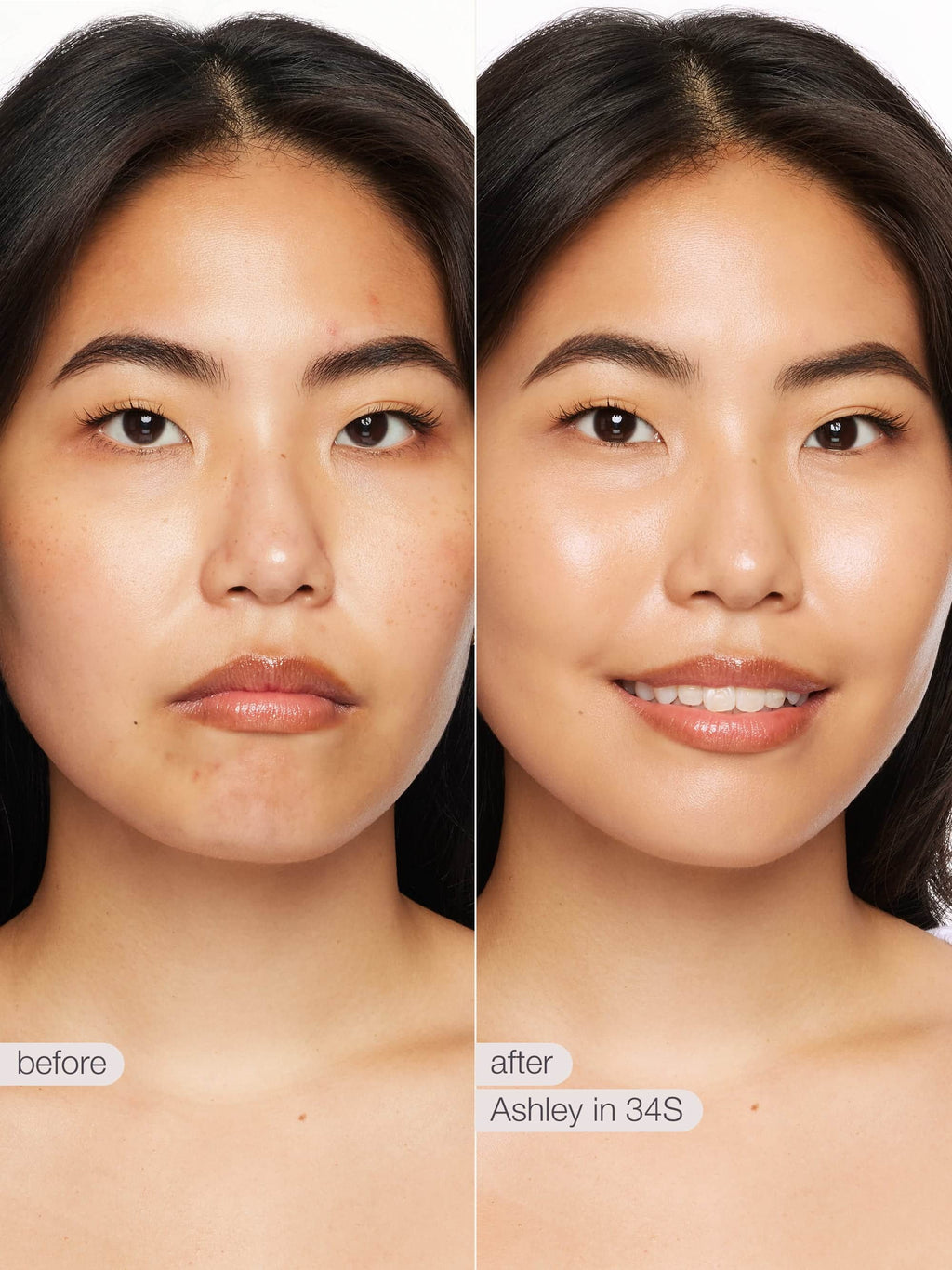 Before and after comparison of a woman's face with text labels 'before' and 'after'.