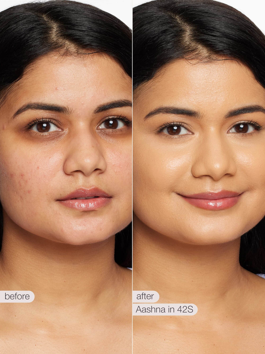 Before and after comparison of a woman's face with text indicating a skincare treatment.