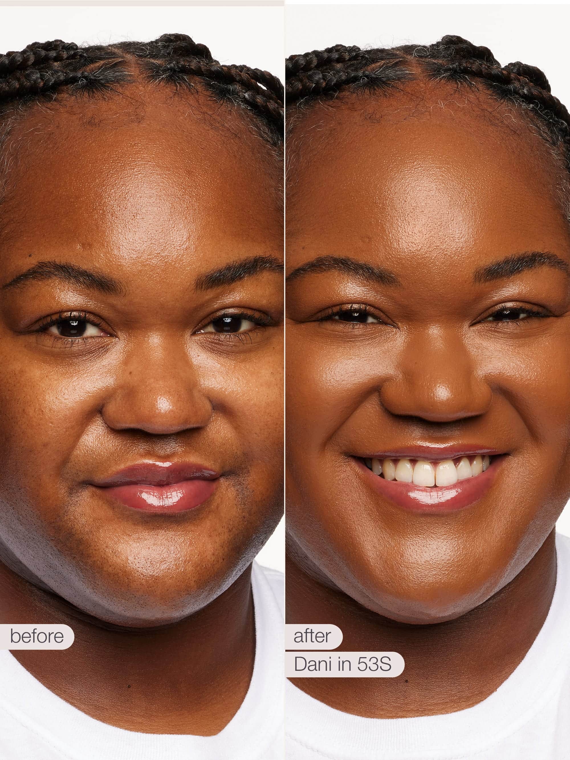 Before and after comparison of a woman's face with text labels 'before' and 'after' on a white background.