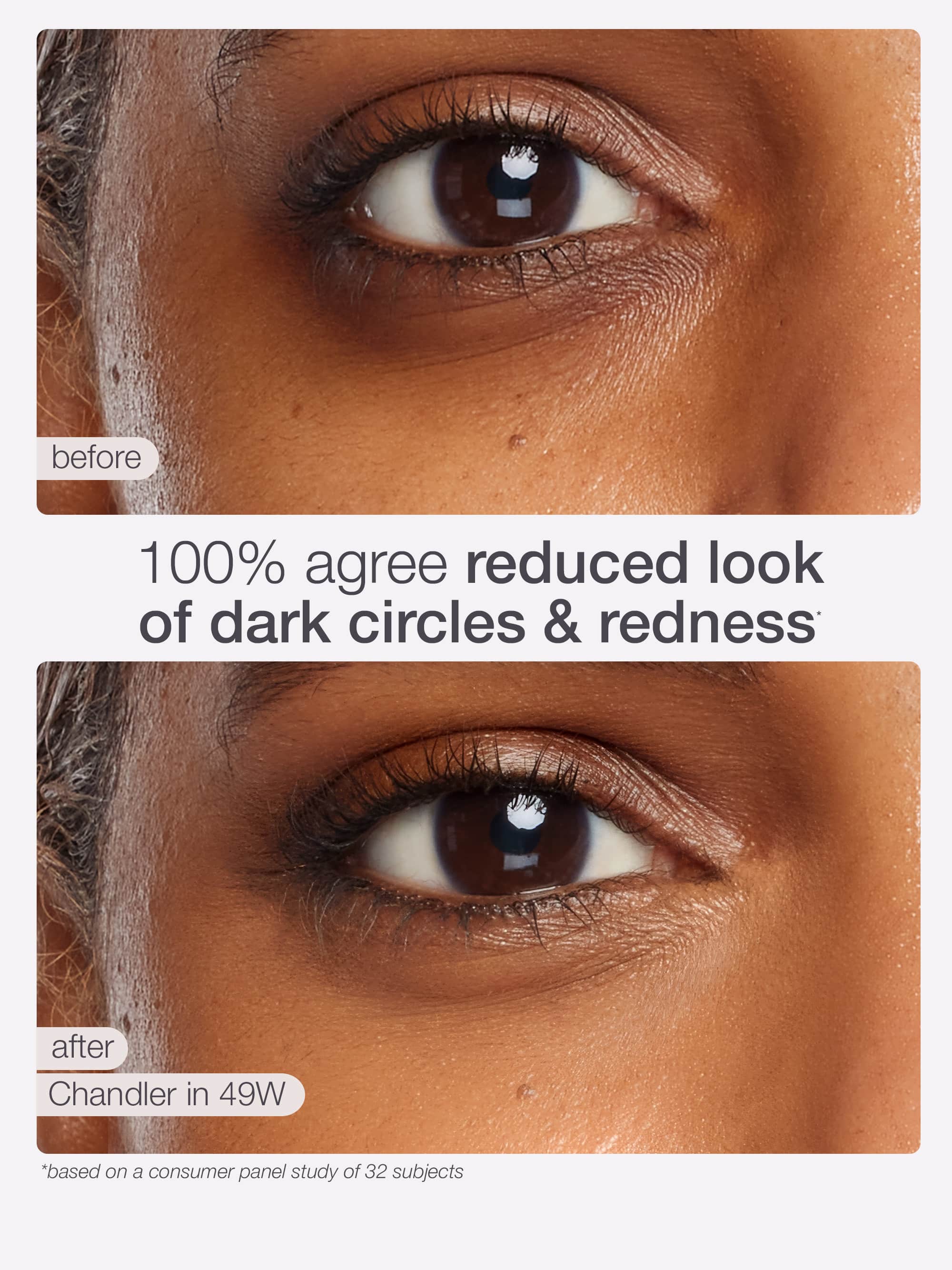 Before and after comparison of dark circles and redness reduction on a person's eye using Chandler product.