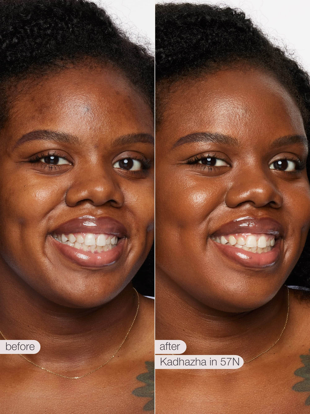 Before and after comparison of a woman's face with Kadhazha skincare product.