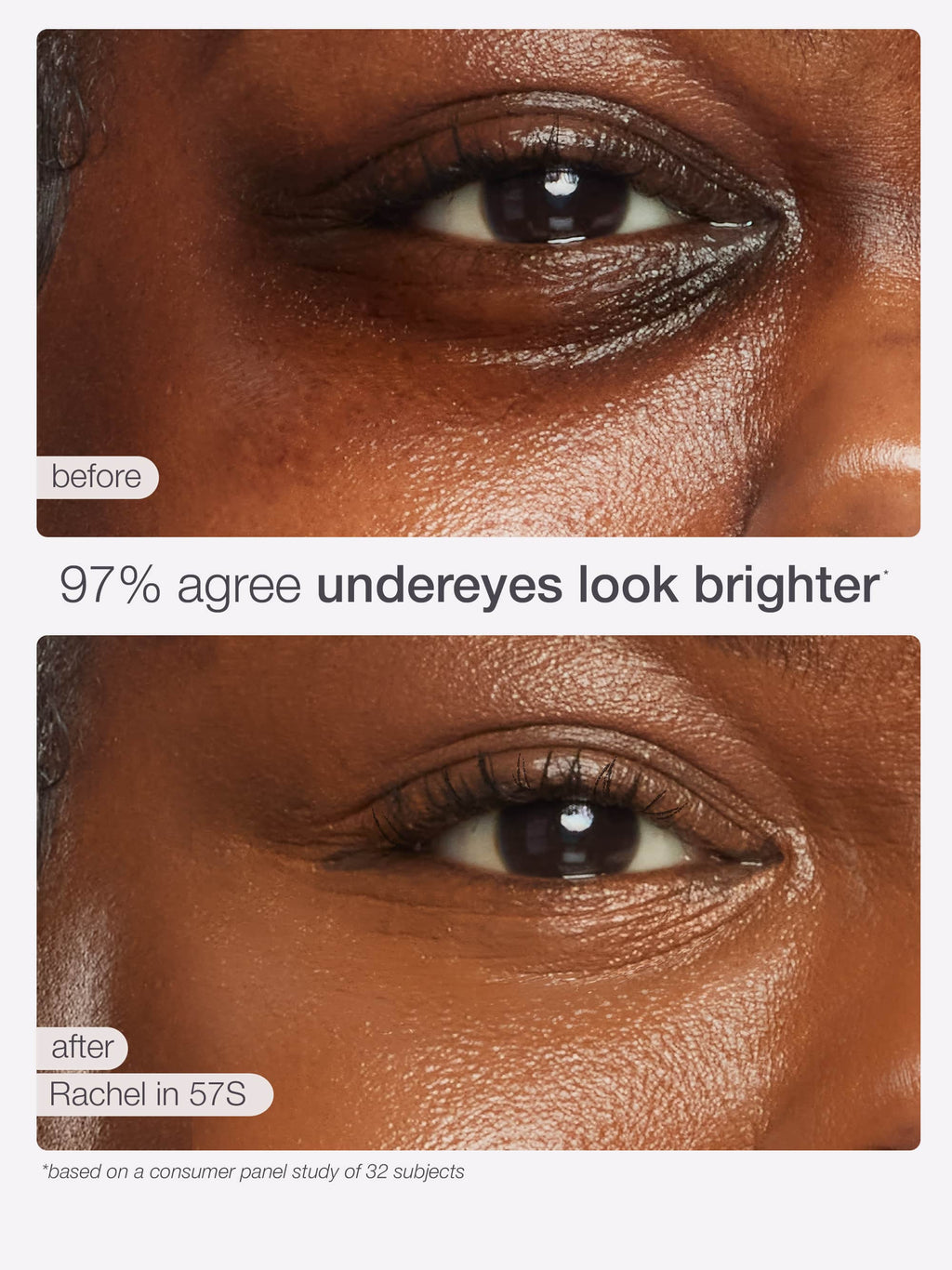 Before and after comparison of under-eye makeup on a person's eye, showing a brighter appearance.