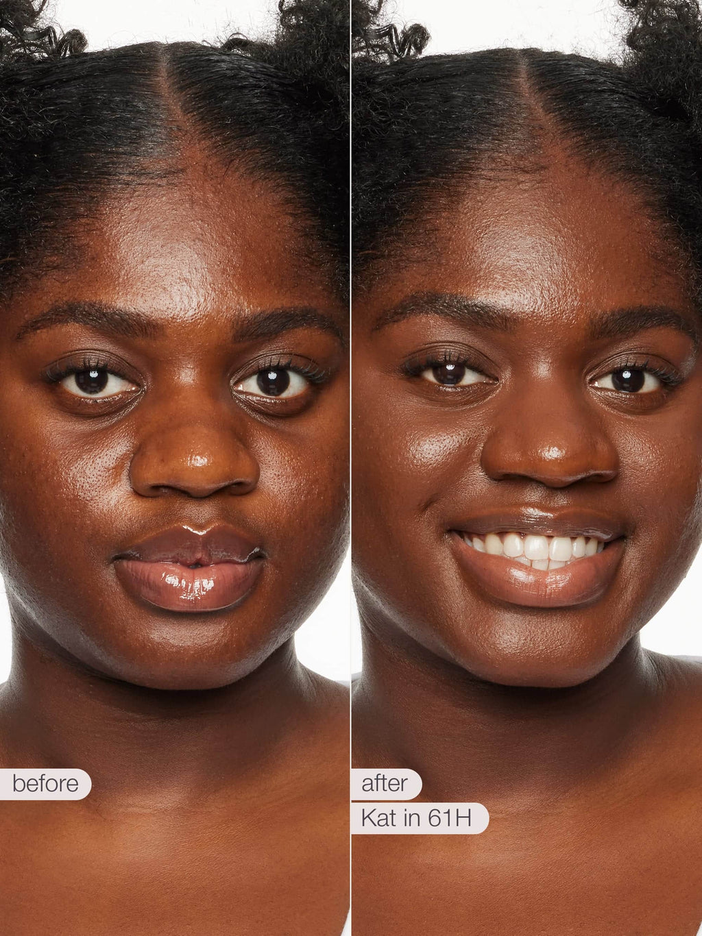 Before and after comparison of a woman's face with visible skin improvement.