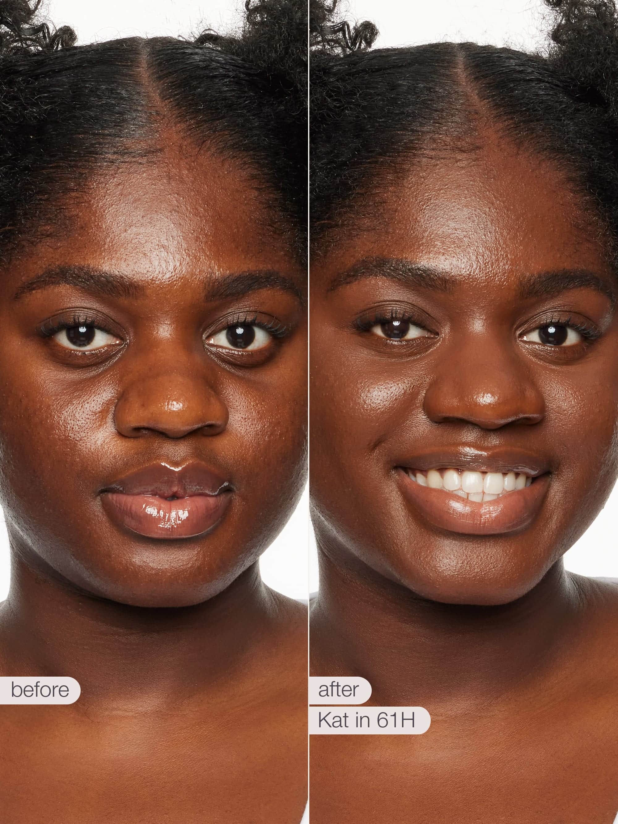 Before and after comparison of a woman's face with visible skin improvement.